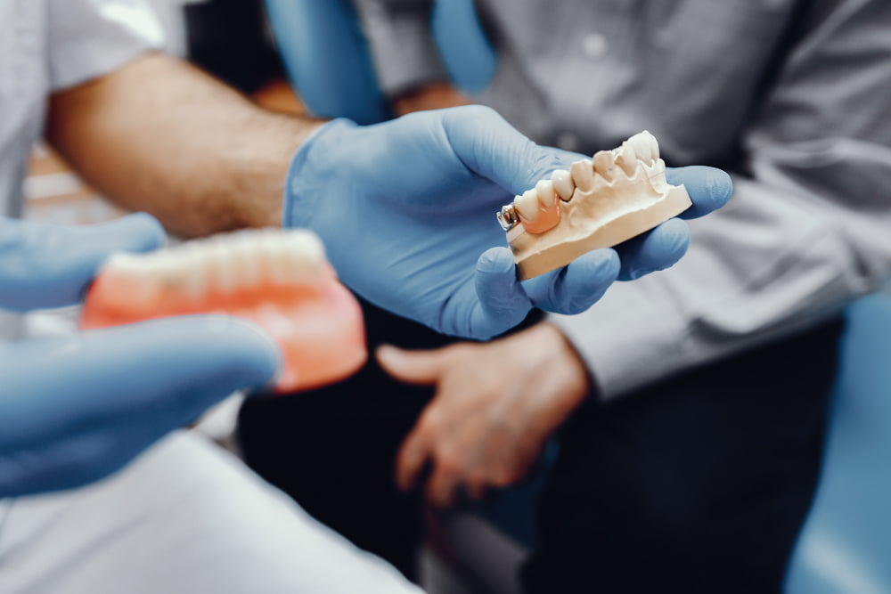 Prótese Protocolo: Solução definitiva para a perda total de dentes 3 Prótese Protocolo